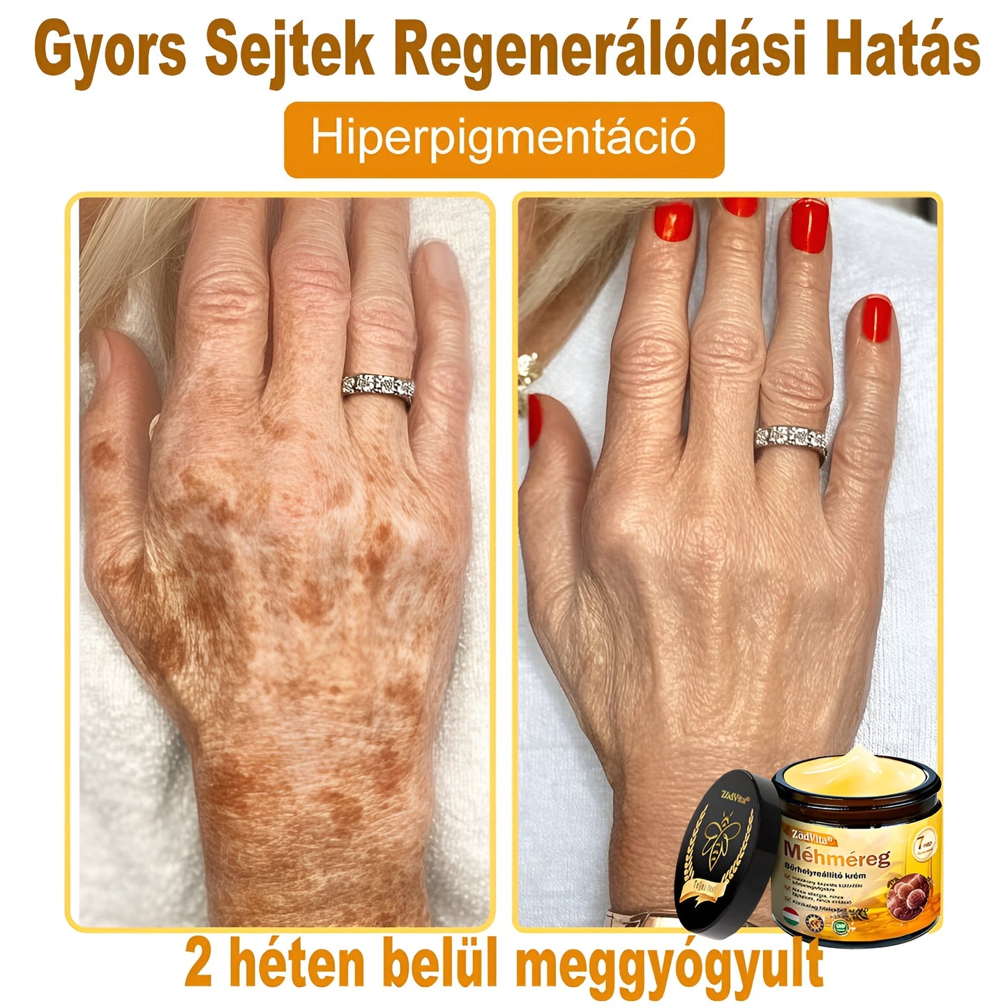 ✨✨ ZödVita® Méhméreg Bőr Helyreállító Krém 🔥 Magyar fejlesztés, magyarországi gyártás és szállítás-50ml