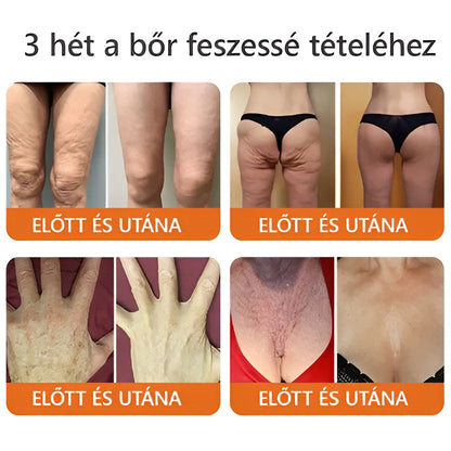 💛 💛 ZödVita® Méhméreg Bőr Helyreállító Krém 🔥 Magyar fejlesztés, magyarországi gyártás és szállítás