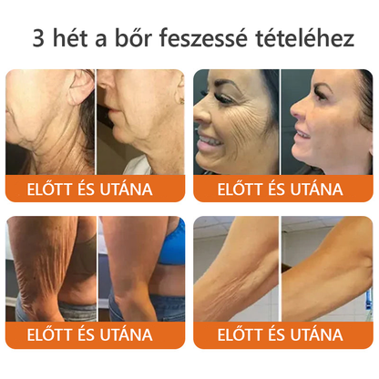💛 💛 ZödVita® Méhméreg Bőr Helyreállító Krém 🔥 Magyar fejlesztés, magyarországi gyártás és szállítás