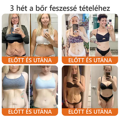 💛 ZödVita® Méhméreg Bőr Helyreállító Krém 🔥 Magyar fejlesztés, magyarországi gyártás és szállítás