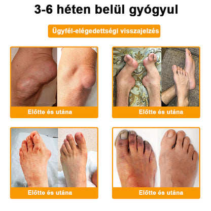 🧡𝑺𝒕𝒂𝒘𝑽𝒊𝒕𝒂𝒍® Botoxot és Méhmérget Tartalmazó Regeneráló Krém Ízületekre és Csontokra | MOT (Magyar Ortopéd Társaság) által tanúsított termék