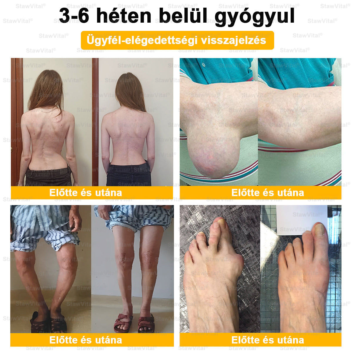 🧡𝑺𝒕𝒂𝒘𝑽𝒊𝒕𝒂𝒍® Botoxot és Méhmérget Tartalmazó Regeneráló Krém Ízületekre és Csontokra | MOT (Magyar Ortopéd Társaság) által tanúsított termék