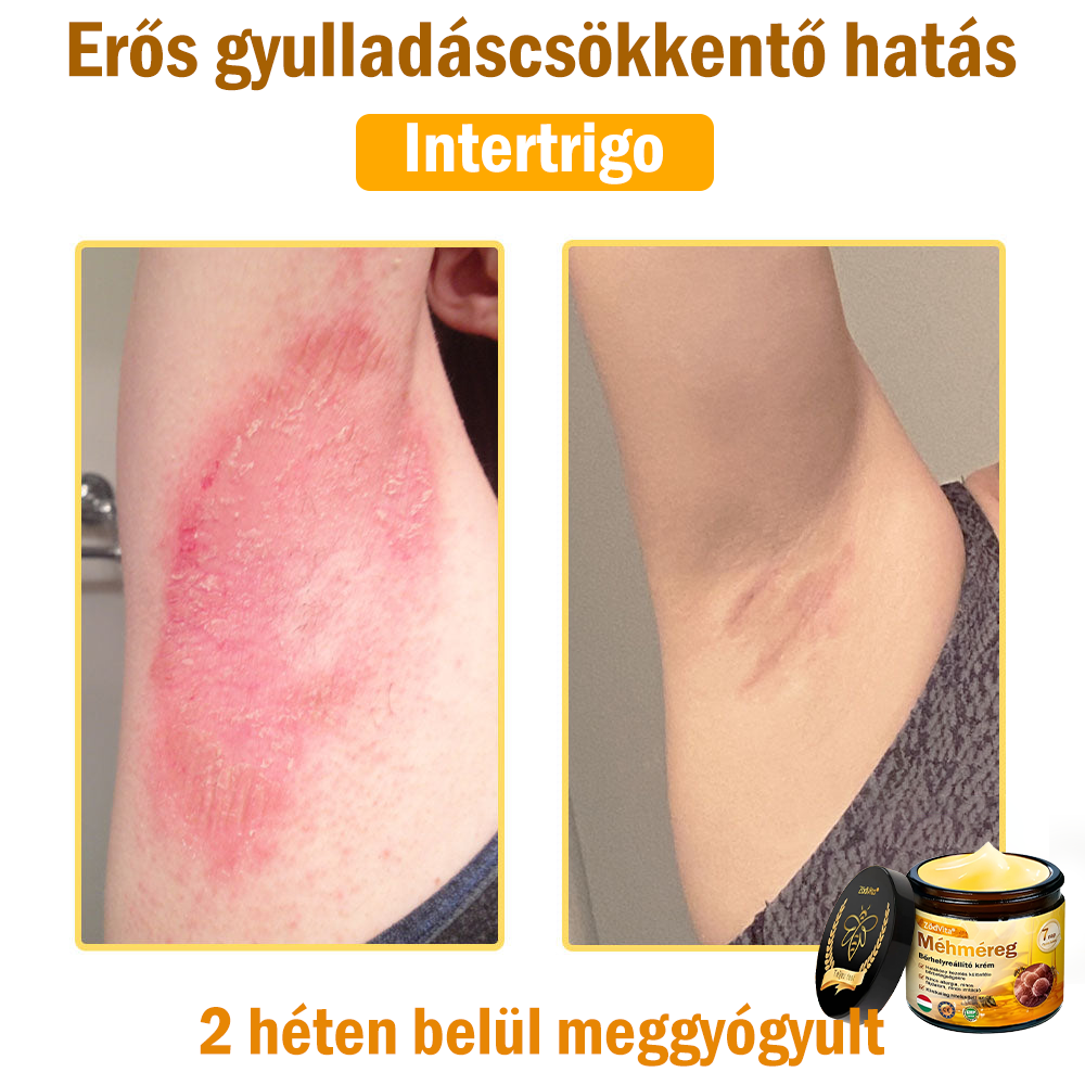 💛 💛 ZödVita® Méhméreg Bőr Helyreállító Krém 🔥 Magyar fejlesztés, magyarországi gyártás és szállítás