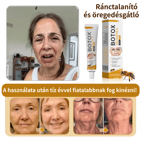 💛FrissArc™ Botox Méhméreg Ránctalanító Krém