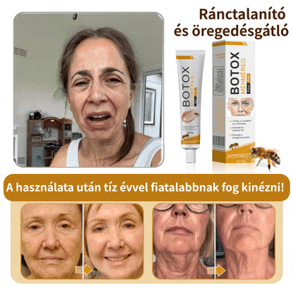 💛FrissArc™ Botox Méhméreg Ránctalanító Krém