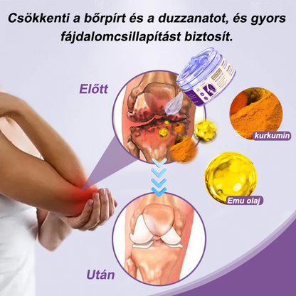 💜OruaFlex™ Kurkuma & Emu Olaj Ízületi Fájdalomcsillapító Masszázs Gél👨‍⚕️Az Ortopédiai Társaság (MOT) által jóváhagyva