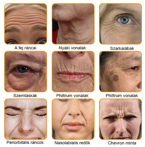 💛FrissArc™ Botox Méhméreg Ránctalanító Krém