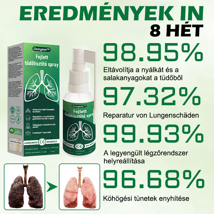 💚Gooyeer™ Fejlett Tüdőtisztító Spray - Tüdőspecialisták ajánlásával -CE tanúsítvánnyal rendelkezik