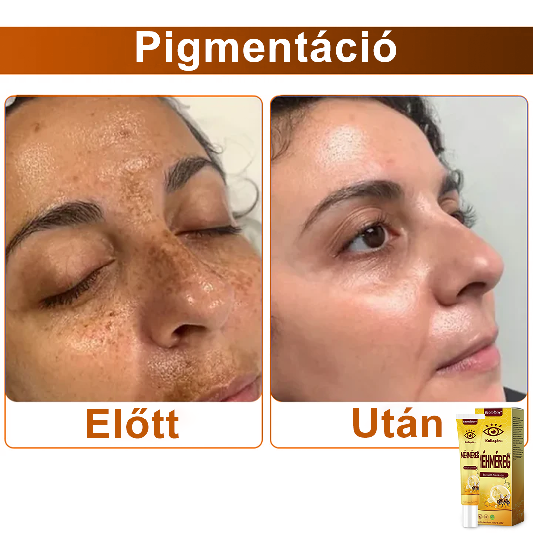 💛SzemFény™ Kollagén+ Méhméreg Ébresztő Szemkrém - Bőrgyógyász Által Ajánlott - CE minősítést szerzett