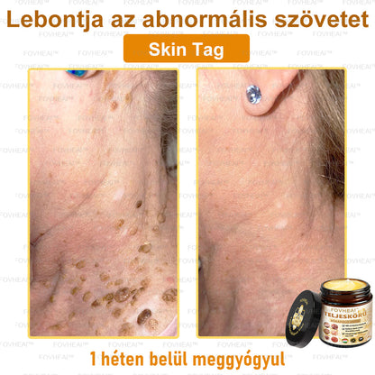 💎🏆💎FOVHEAl™ Méhméreg Teljeskörű Bőrápoló Krém - Antioxidáns, hidratáló, bőrfelújító, bőrszín-egyensúlyozó, akne és sötét foltok kezelése, szemölcs és anyajegy eltávolítása, pikkelysömör enyhítése