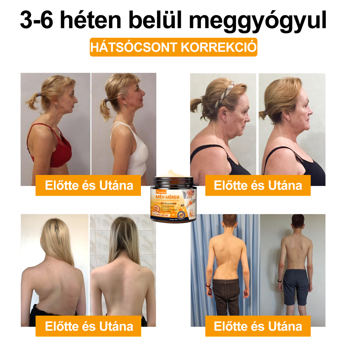 🐝🌟𝐈𝐳𝐮̈𝐥𝐞𝐭𝐢𝐕𝐢𝐭𝐚𝐥™ Méh Méreg Ízületi Regeneráló Krém - CE minősítést szerzett - Minden korosztály számára alkalmas
