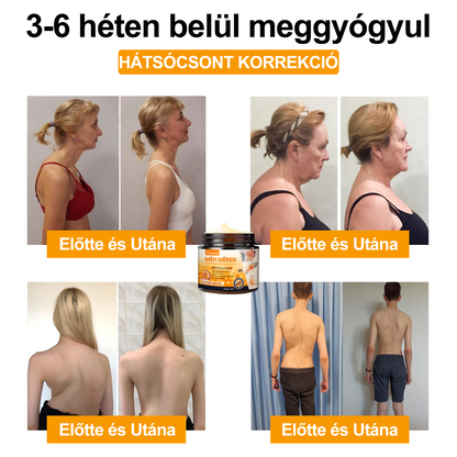 🐝🌟𝐈𝐳𝐮̈𝐥𝐞𝐭𝐢𝐕𝐢𝐭𝐚𝐥™ Méh Méreg Ízületi Regeneráló Krém - CE minősítést szerzett - Minden korosztály számára alkalmas