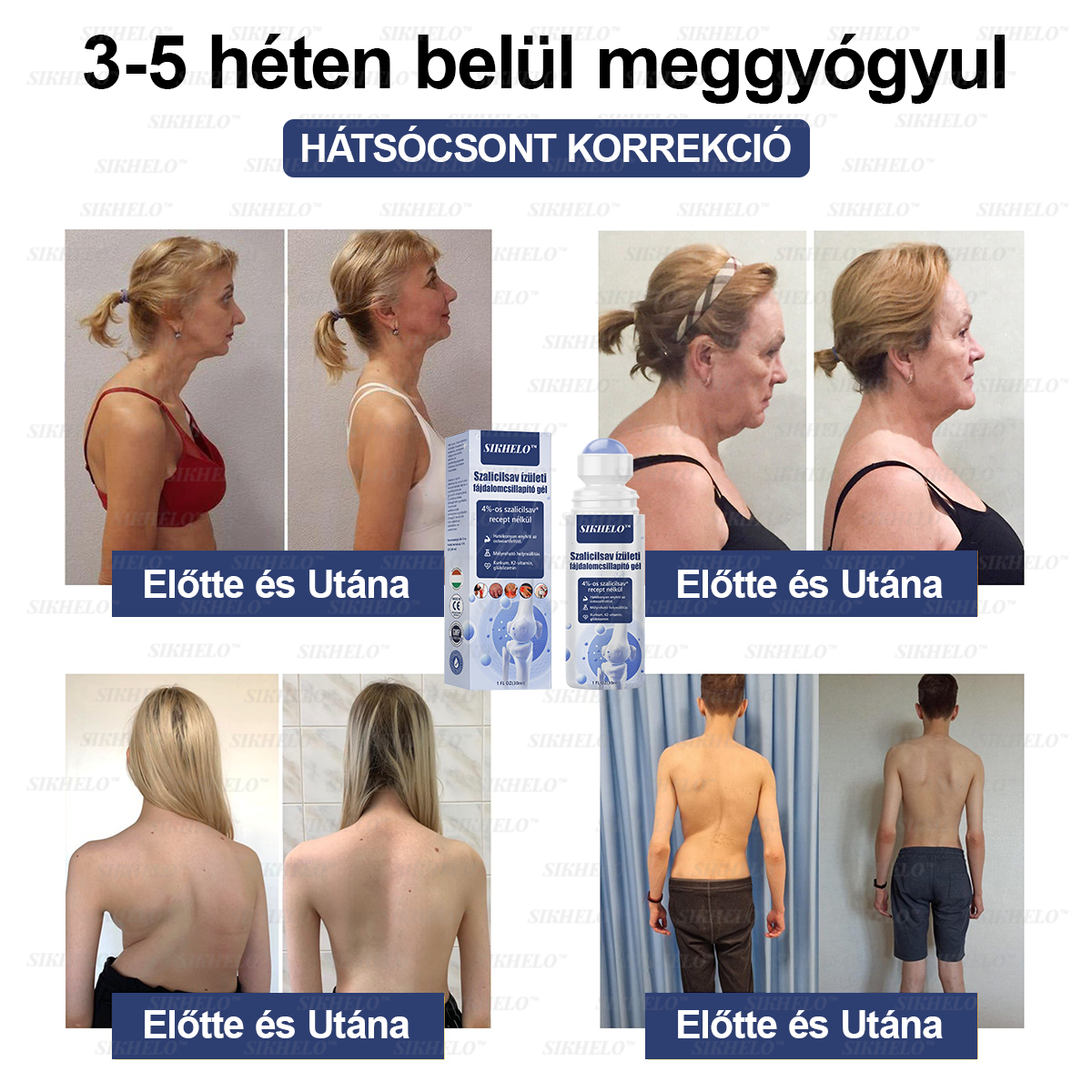 💠💧💠SIKHELO™ Szalicilsav ízületi fájdalomcsillapító gél -Az EFORT és az OGYÉI általi jóváhagyással - Minden korosztály számára alkalmas