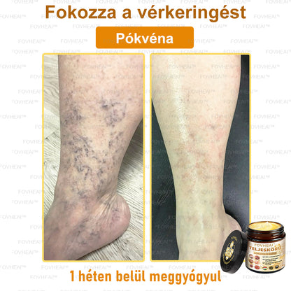 💎🏆💎FOVHEAl™ Méhméreg Teljeskörű Bőrápoló Krém - Antioxidáns, hidratáló, bőrfelújító, bőrszín-egyensúlyozó, akne és sötét foltok kezelése, szemölcs és anyajegy eltávolítása, pikkelysömör enyhítése