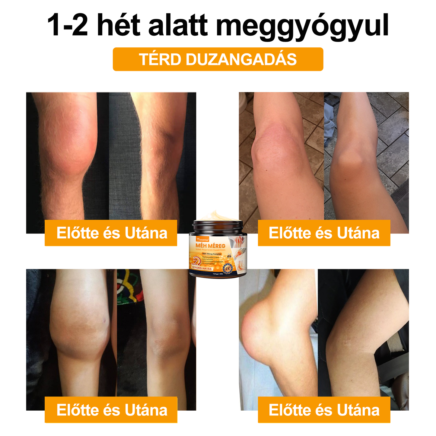 🐝🌟𝐈𝐳𝐮̈𝐥𝐞𝐭𝐢𝐕𝐢𝐭𝐚𝐥™ Méh Méreg Ízületi Regeneráló Krém - CE minősítést szerzett - Minden korosztály számára alkalmas
