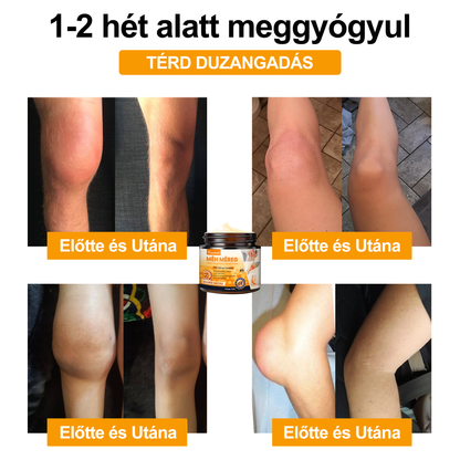 🐝🌟𝐈𝐳𝐮̈𝐥𝐞𝐭𝐢𝐕𝐢𝐭𝐚𝐥™ Méh Méreg Ízületi Regeneráló Krém - CE minősítést szerzett - Minden korosztály számára alkalmas