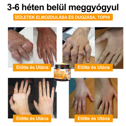 🐝🌟𝐈𝐳𝐮̈𝐥𝐞𝐭𝐢𝐕𝐢𝐭𝐚𝐥™ Méh Méreg Ízületi Regeneráló Krém - CE minősítést szerzett - Minden korosztály számára alkalmas