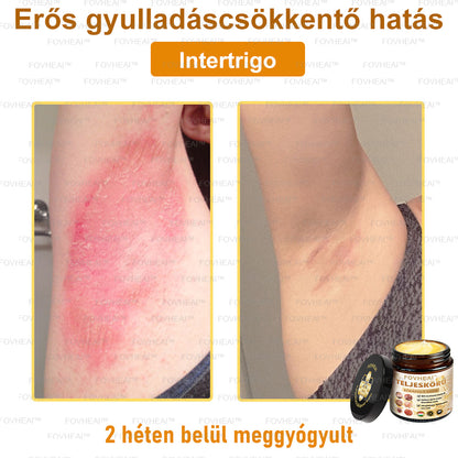 💎🏆💎FOVHEAl™ Méhméreg Teljeskörű Bőrápoló Krém - Antioxidáns, hidratáló, bőrfelújító, bőrszín-egyensúlyozó, akne és sötét foltok kezelése, szemölcs és anyajegy eltávolítása, pikkelysömör enyhítése