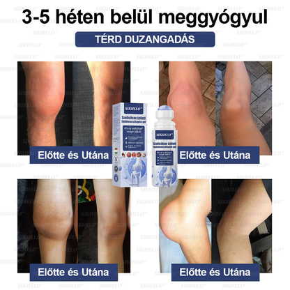 💠💧💠SIKHELO™ Szalicilsav ízületi fájdalomcsillapító gél -Az EFORT és az OGYÉI általi jóváhagyással - Minden korosztály számára alkalmas