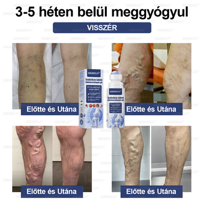 💠💧💠SIKHELO™ Szalicilsav ízületi fájdalomcsillapító gél -Az EFORT és az OGYÉI általi jóváhagyással - Minden korosztály számára alkalmas