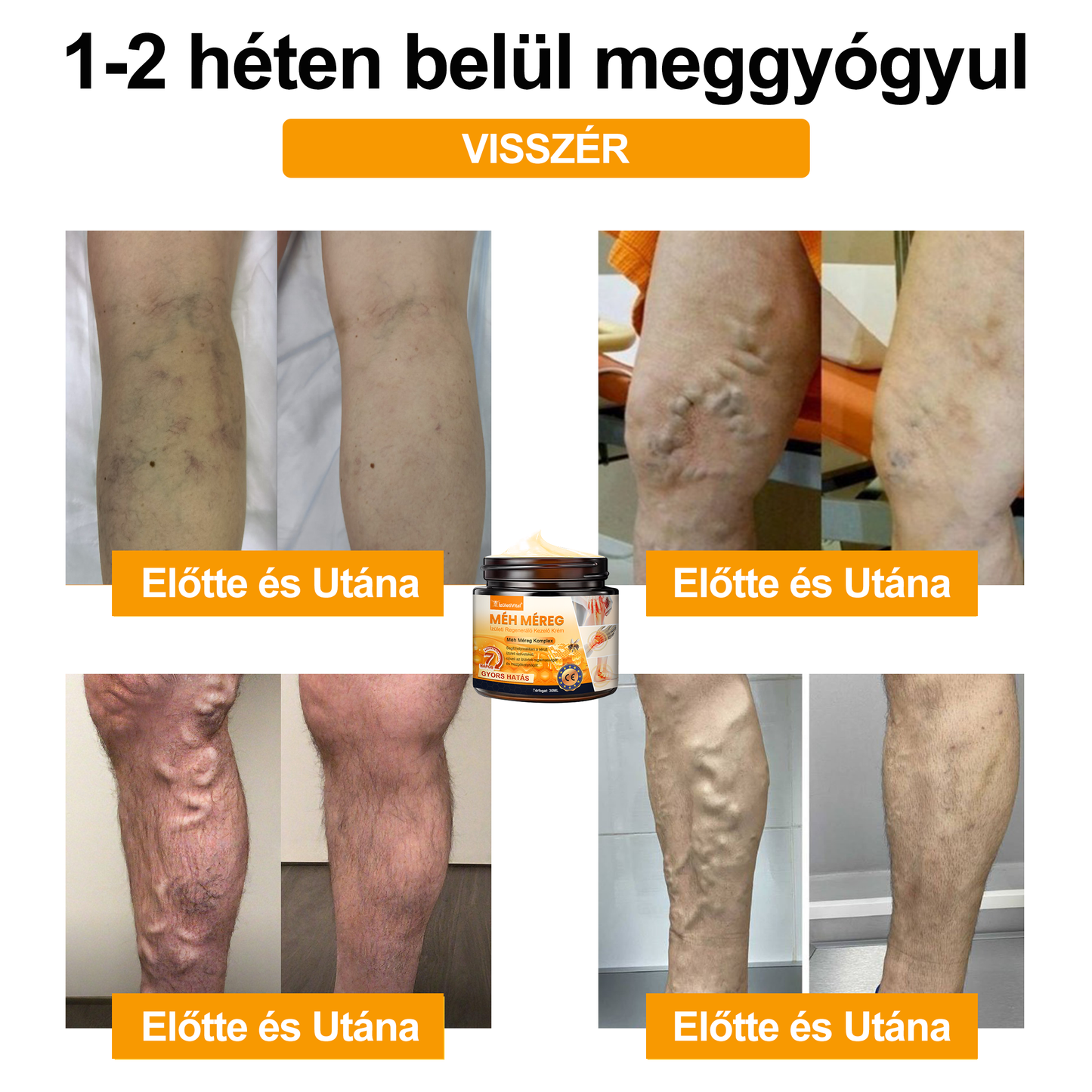 🐝🌟𝐈𝐳𝐮̈𝐥𝐞𝐭𝐢𝐕𝐢𝐭𝐚𝐥™ Méh Méreg Ízületi Regeneráló Krém - CE minősítést szerzett - Minden korosztály számára alkalmas