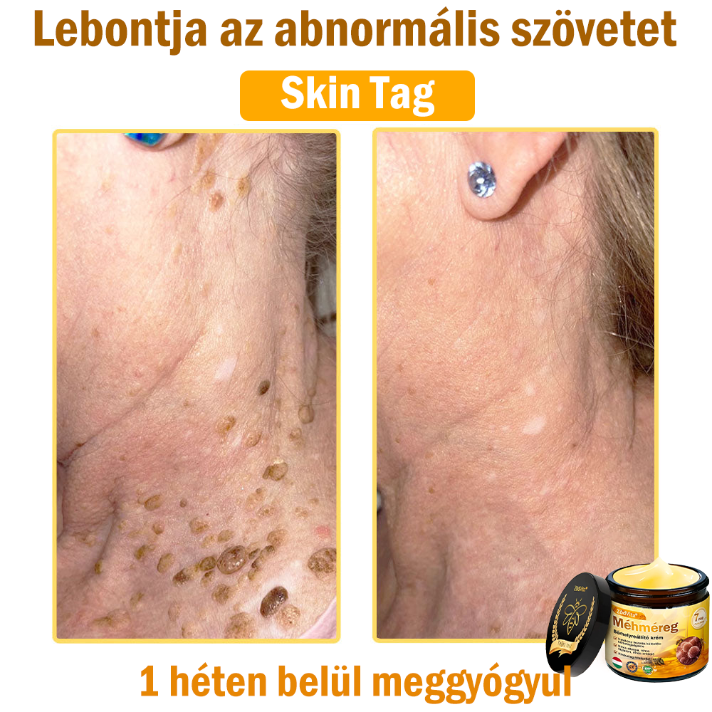 💛 💛 ZödVita® Méhméreg Bőr Helyreállító Krém 🔥 Magyar fejlesztés, magyarországi gyártás és szállítás