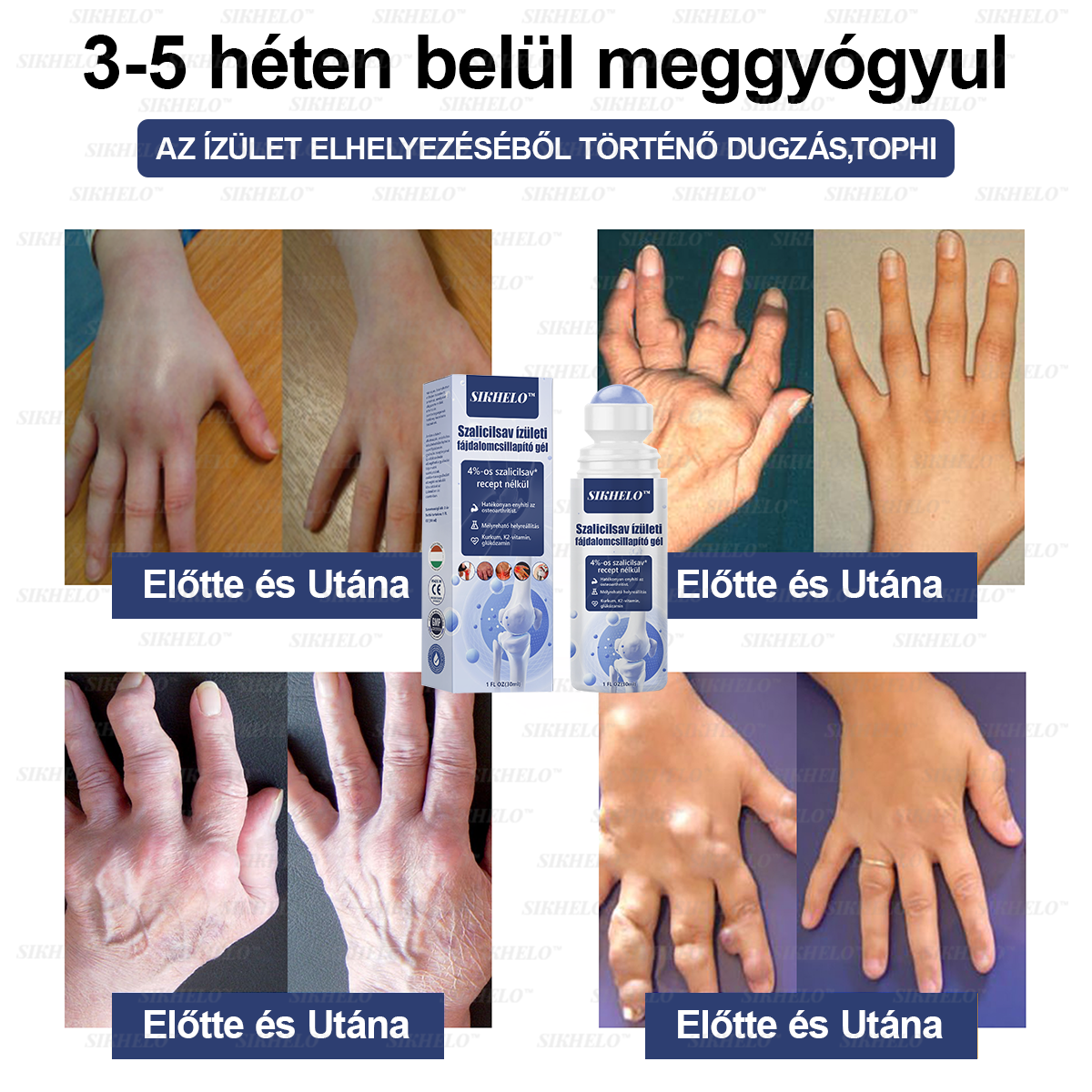 💠💧💠SIKHELO™ Szalicilsav ízületi fájdalomcsillapító gél -Az EFORT és az OGYÉI általi jóváhagyással - Minden korosztály számára alkalmas