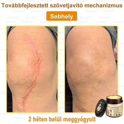 💎🏆💎FOVHEAl™ Méhméreg Teljeskörű Bőrápoló Krém - Antioxidáns, hidratáló, bőrfelújító, bőrszín-egyensúlyozó, akne és sötét foltok kezelése, szemölcs és anyajegy eltávolítása, pikkelysömör enyhítése