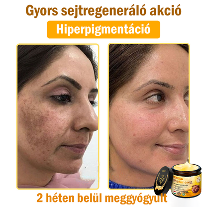 💛 💛 ZödVita® Méhméreg Bőr Helyreállító Krém 🔥 Magyar fejlesztés, magyarországi gyártás és szállítás
